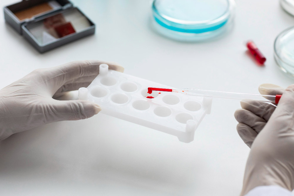 Dobrovoljno i povjerljivo testiranje na HIV u Mostaru